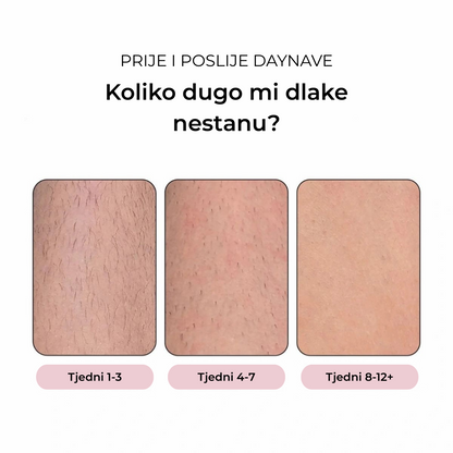 Daynava™ IPL Epilator (HR)
