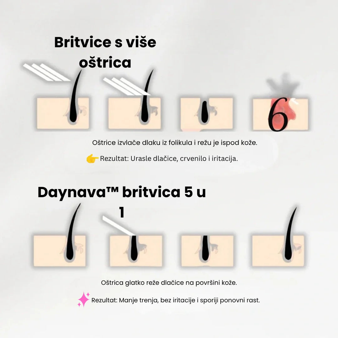 Daynava™ 5u1 Električni Brijaći Aparat