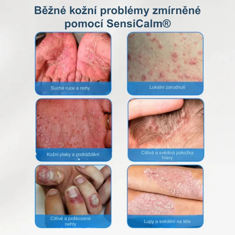 Zklidňující krém na pokožku hlavy a kůži