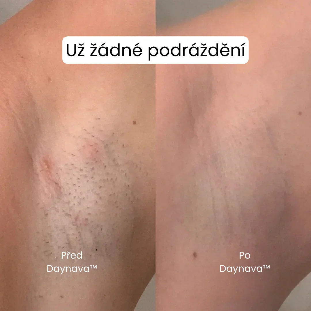 Daynava™ 5-v-1 Elektrický Holicí Strojek
