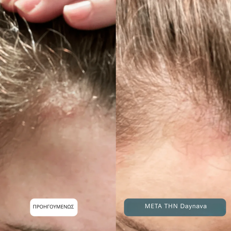 Καταπραϋντική Κρέμα για Τριχωτό & Δέρμα