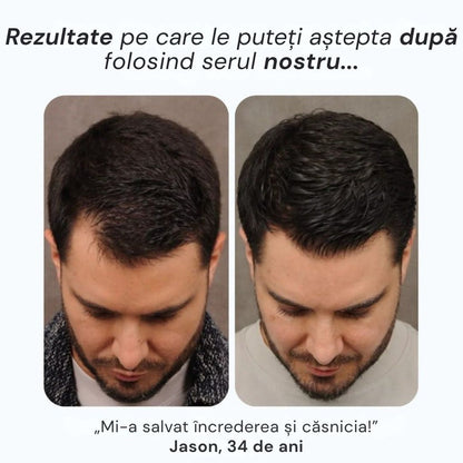 Daynava™ Roll-On pentru Creșterea Părului RO