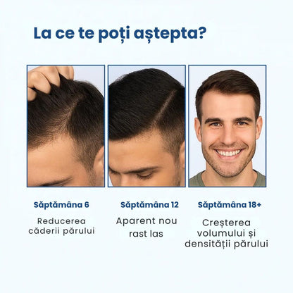 Daynava™ Roll-On pentru Creșterea Părului RO